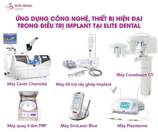 Hệ thống máy móc, trang thiết bị trồng răng Implant tối tân đồng bộ tại Elite Dental