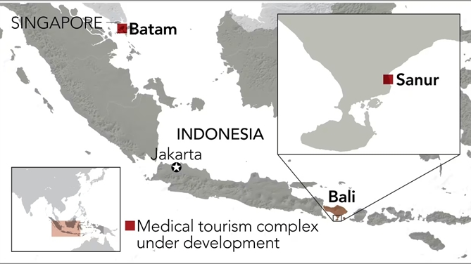 Bali mo 